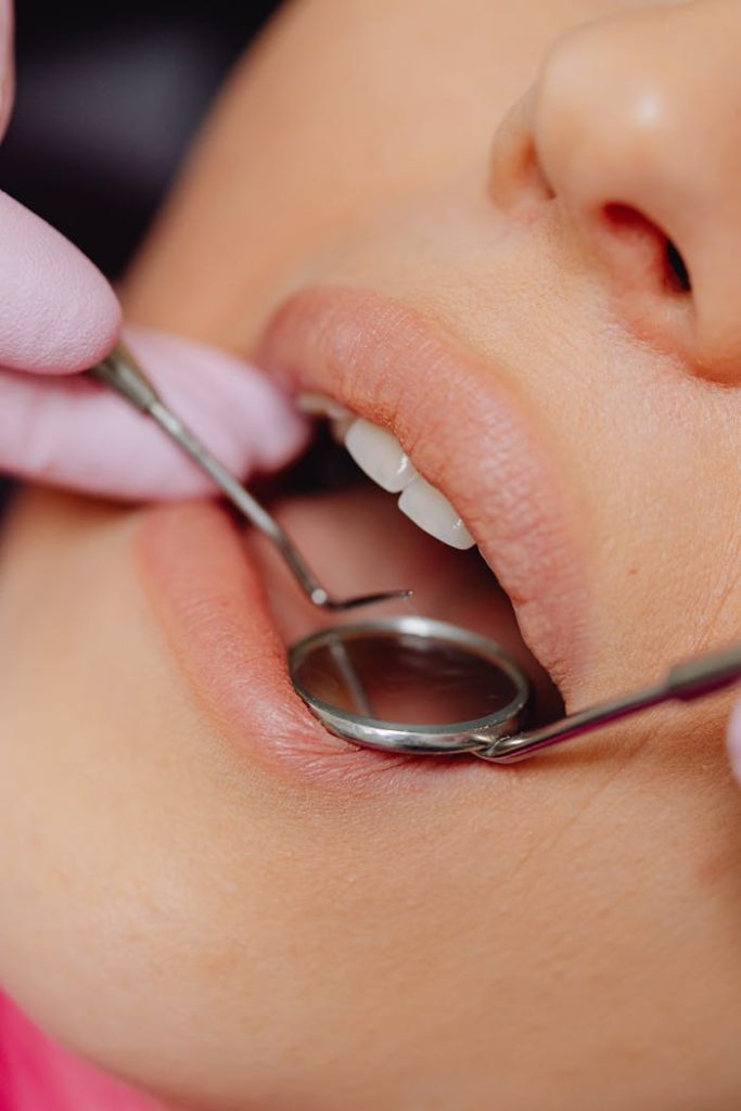 close-up-of-dental-tools-in-a-patient-s-mouth-6627531 Close-up view of a patients dental check-up using dental mirror and tools.